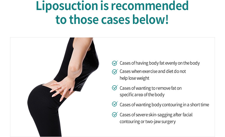 Liposuction is recommended to those cases below!