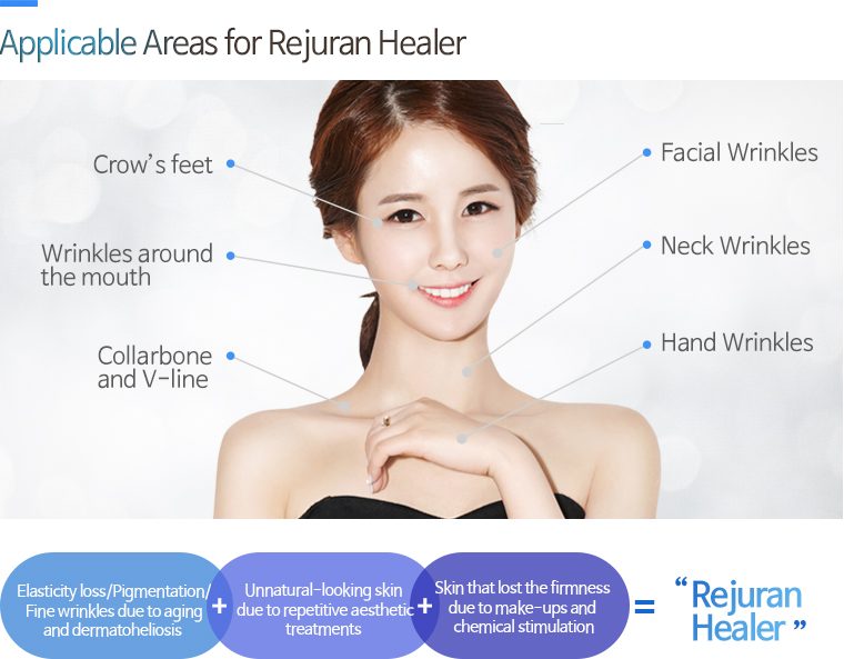 Applicable Areas for Rejuran Healer