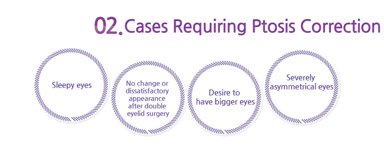 cases requiring ptosis correction