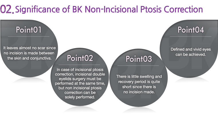 Significance of BK Non-Incisional Ptosis Correction